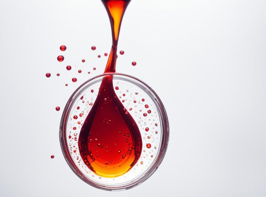 Blood in urine (hematuria)