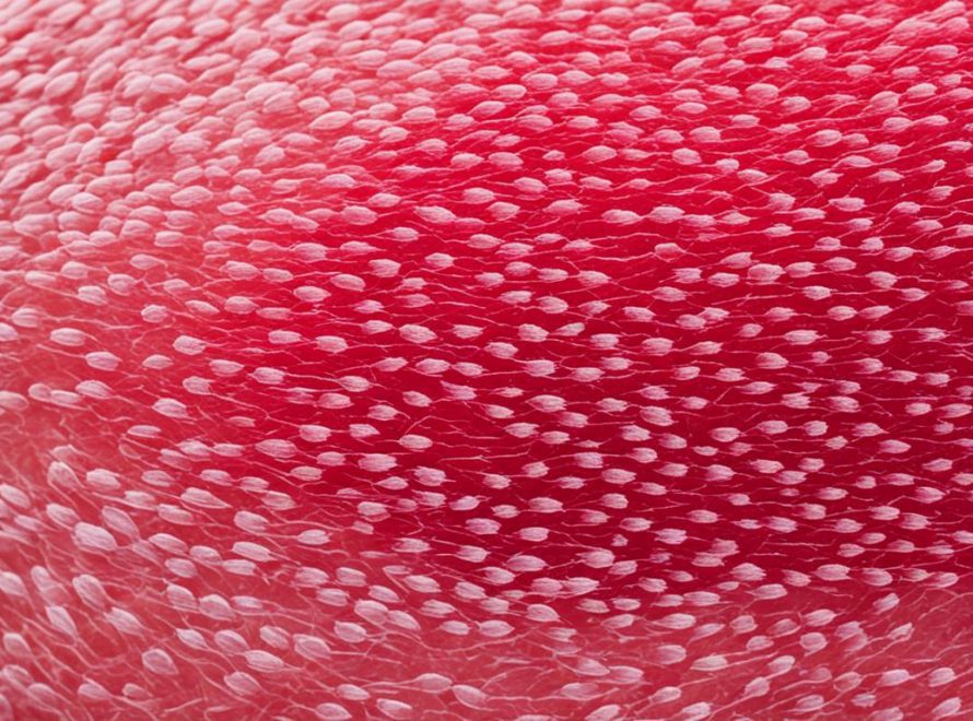 Folliculitis