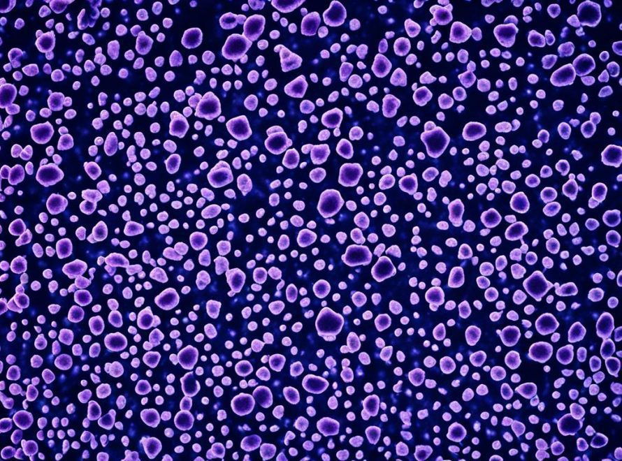 Hereditary nonpolyposis colorectal cancer syndrome
